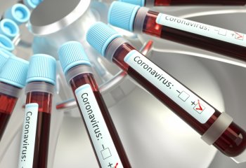 Polskie firmy boją się koronawirusa, ale… umiarkowanie