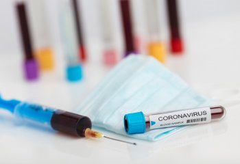 CEO VTS Group - Działania prewencyjne VTS Group - Koronawirus (COVID-19)